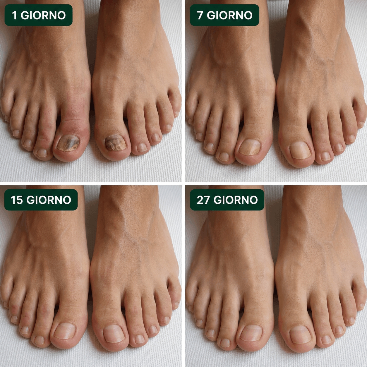 Risultato Micostop 2